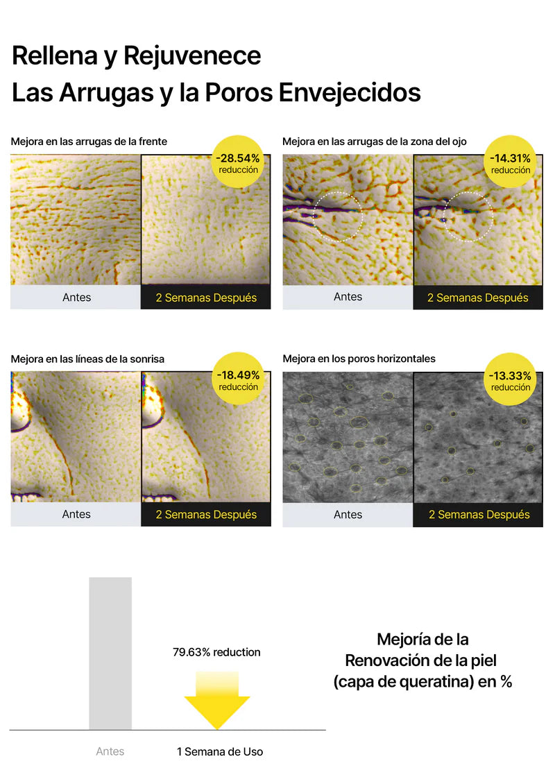 Retinal Skin Renewal