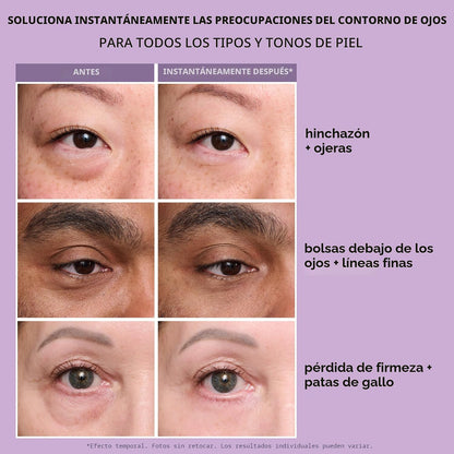 Crema para tensar bolsas de Ojos- instantaneo